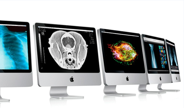 teleradiology